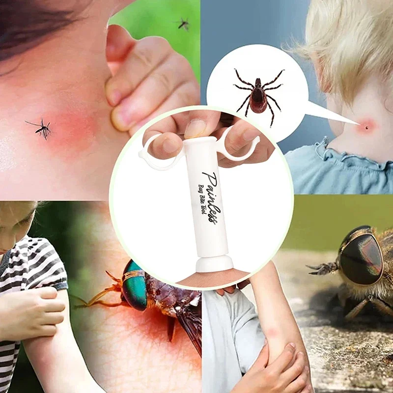Insect Bite Suction Venom Extr - Outdoor Furniture Hay のレビューと価格
