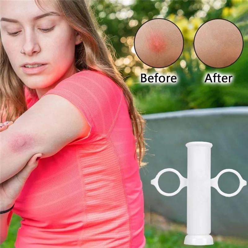 Insect Bite Suction Venom Extr - Outdoor Furniture Hay のレビューと価格